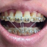 2026年2月19日の様子