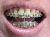 2026年2月19日の様子