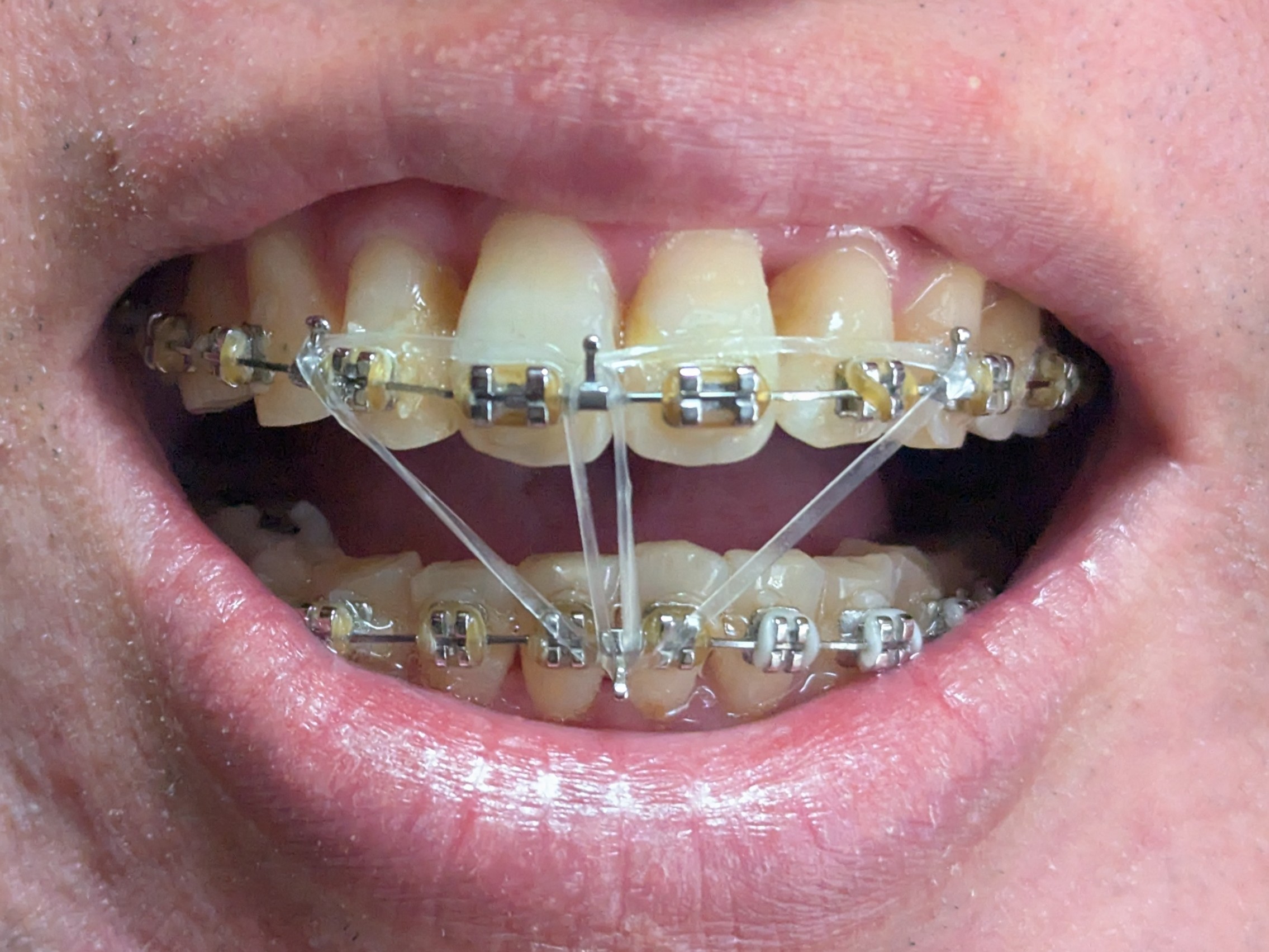 2026年2月19日の様子