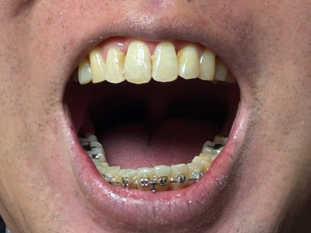 口を開いている様子